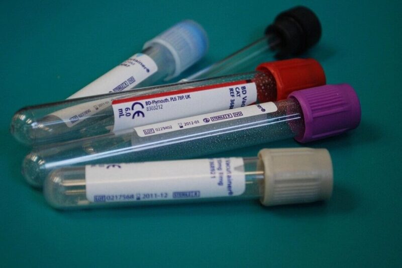 Small-cap stock Thyrocare Tech announces ₹7 dividend, 2:1 bonus issue. Check details