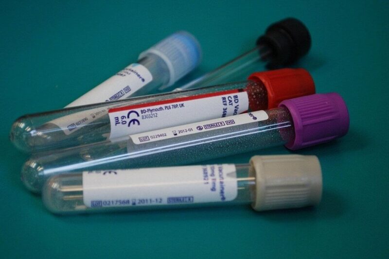 Dr Lal PathLabs Q2 Results: Profit jumps 16% YoY to ₹152 crore; ₹7 dividend, 1:1 bonus issue announced